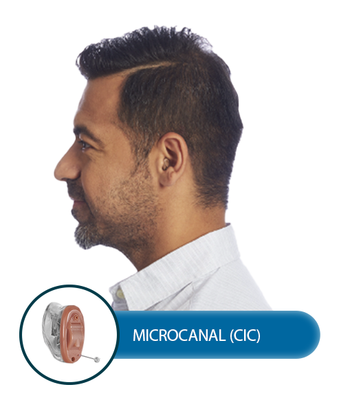 Microcanal_CIC.png